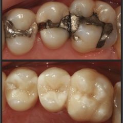 Imagem da notícia: Curso Modular Te&oacute;rico-Pr&aacute;tico de Dentisteria Est&eacute;tica
