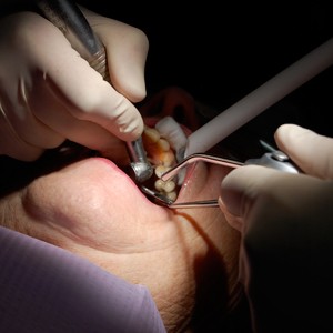 Imagem da notícia: Novo tratamento poderá reduzir tempo e custos em implantologia