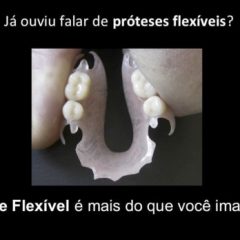 Imagem da notícia: Pr&oacute;teses flex&iacute;veis com 50% de desconto