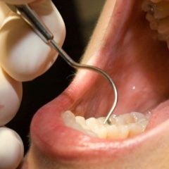 Imagem da notícia: Keep 32: Dentes &agrave; prova de c&aacute;ries