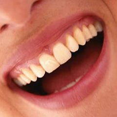 Imagem da notícia: Cientistas brit&acirc;nicos criam dente a partir de c&eacute;lulas da gengiva