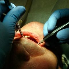 Imagem da notícia: Diminuiu a fatura&ccedil;&atilde;o nos consult&oacute;rios de dentistas