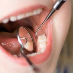 Imagem da notícia: Cuidados prestados por cheques-dentista ser&atilde;o os mesmos ap&oacute;s baixar o valor
