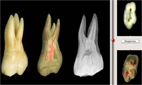 Imagem da notícia: 3D Tooth Atlas é atualizado
