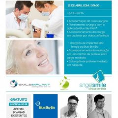 Imagem da notícia: “Cirurgia e Carga Imediata em Desdentado Total: apresenta&ccedil;&atilde;o cl&iacute;nica”