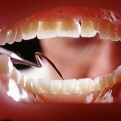 Imagem da notícia: Agressividade do cancro oral pode ser medida