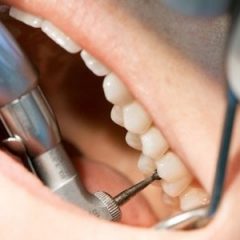 Imagem da notícia: Diab&eacute;ticos devem ser abrangidos por cheques dentista