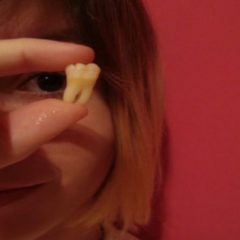 Imagem da notícia: Tratar dos olhos com os dentes?