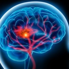 Imagem da notícia: Bact&eacute;ria oral pode estar associada a problemas cerebrais
