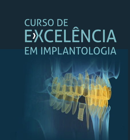 Imagem da notícia: Curso de Excelência em Implantologia inicia este mês