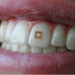 Imagem da notícia: Sensor dentário monitoriza alimentos ingeridos
