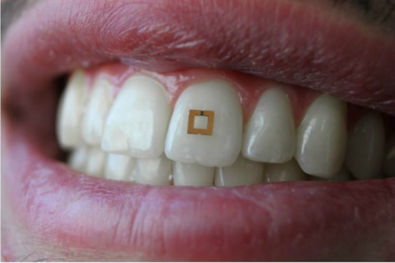 Imagem da notícia: Sensor dentário monitoriza alimentos ingeridos