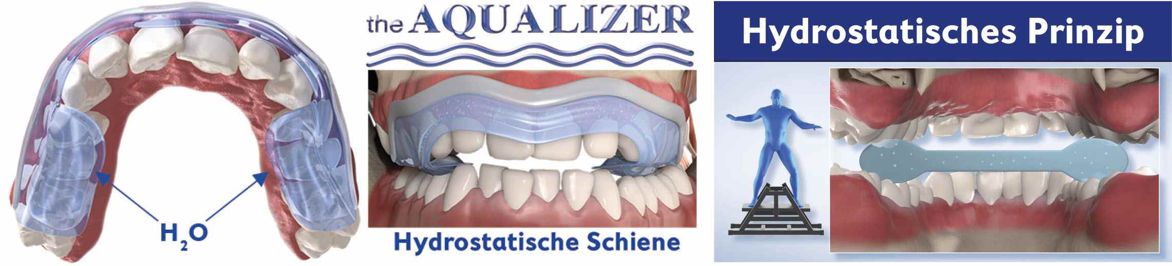 Imagem da notícia: Dental Wave representa sistema Aqualizer