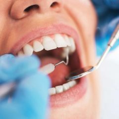 Imagem da notícia: Número de portugueses que não vai ao dentista aumenta