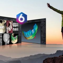 Imagem da notícia: Planmeca revela a nova versão do software Romexis®
