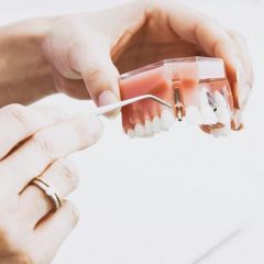 Imagem da notícia: Os biomateriais na medicina dentária regenerativa