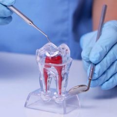 Imagem da notícia: OMD promove curso de Controlo microbiológico em endodontia