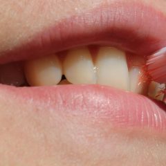Imagem da notícia: Tratamentos de cancro aumentam o risco de anomalias de desenvolvimento dentário, diz estudo