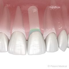 Imagem da notícia: Patent apresenta Symbionic Teeth