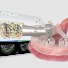 Imagem da notícia: OneGuide da Osstem Implant celebra o seu 10.º aniversário
