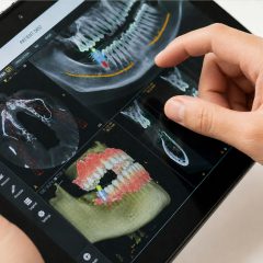 Imagem da notícia: IA aproxima-se de especialistas no planeamento de implantes