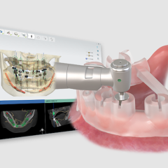 Imagem da notícia: OneGuide da Osstem Implant celebra 10.º aniversário